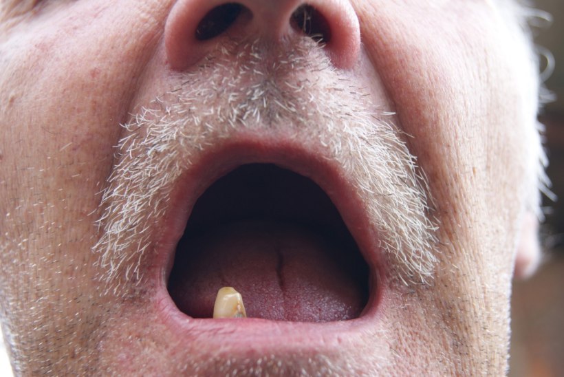 Üheksa harjumust, mis hävitavad su hambad
