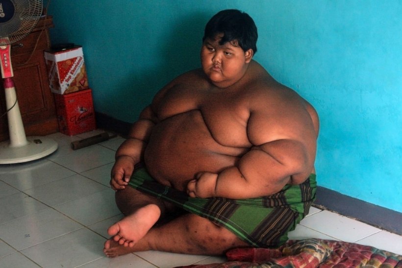 Maailma paksim poiss võttis tänu lõikusele 76 kilo alla