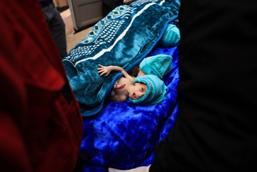Gaza haiglast evakueeriti enneaegselt sündinud imikud