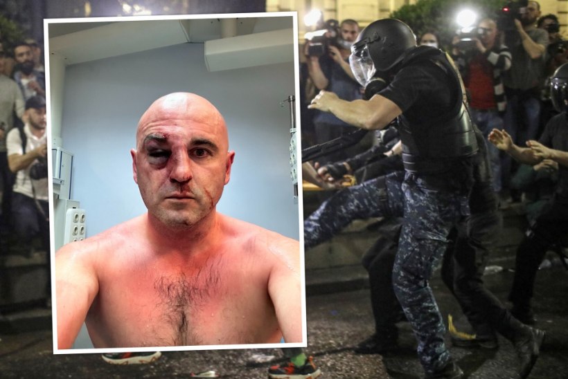 OTSEBLOGI | Gruusia meeleavaldusel läbi pekstud opositsioonijuht kutsus grusiine veelgi rohkem protestima