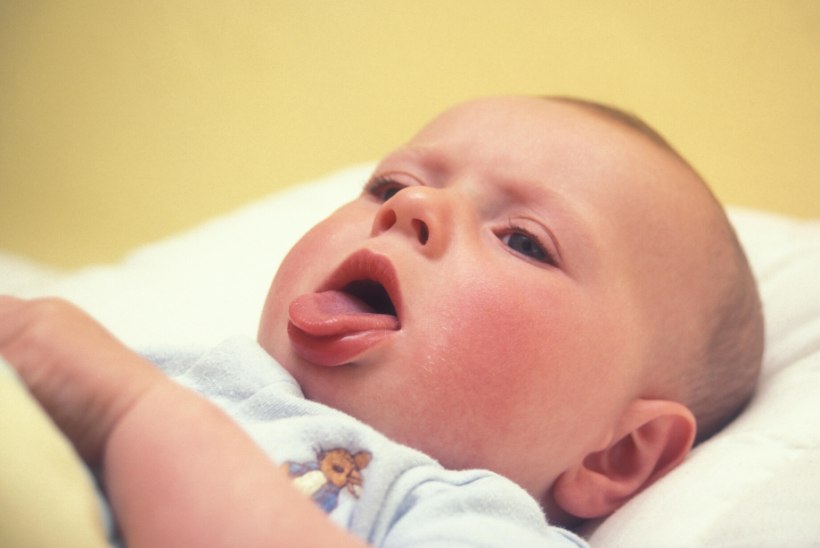 SURMAV HAIGUS:  läkaköha on võtnud Inglismaal viie imiku elu