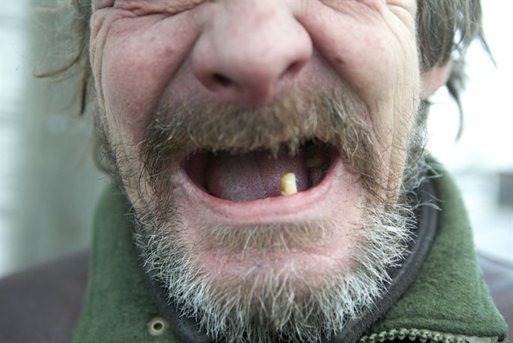 Kolme hambaga maamees: 76eurose sissetulekuga hambaid ei ravi