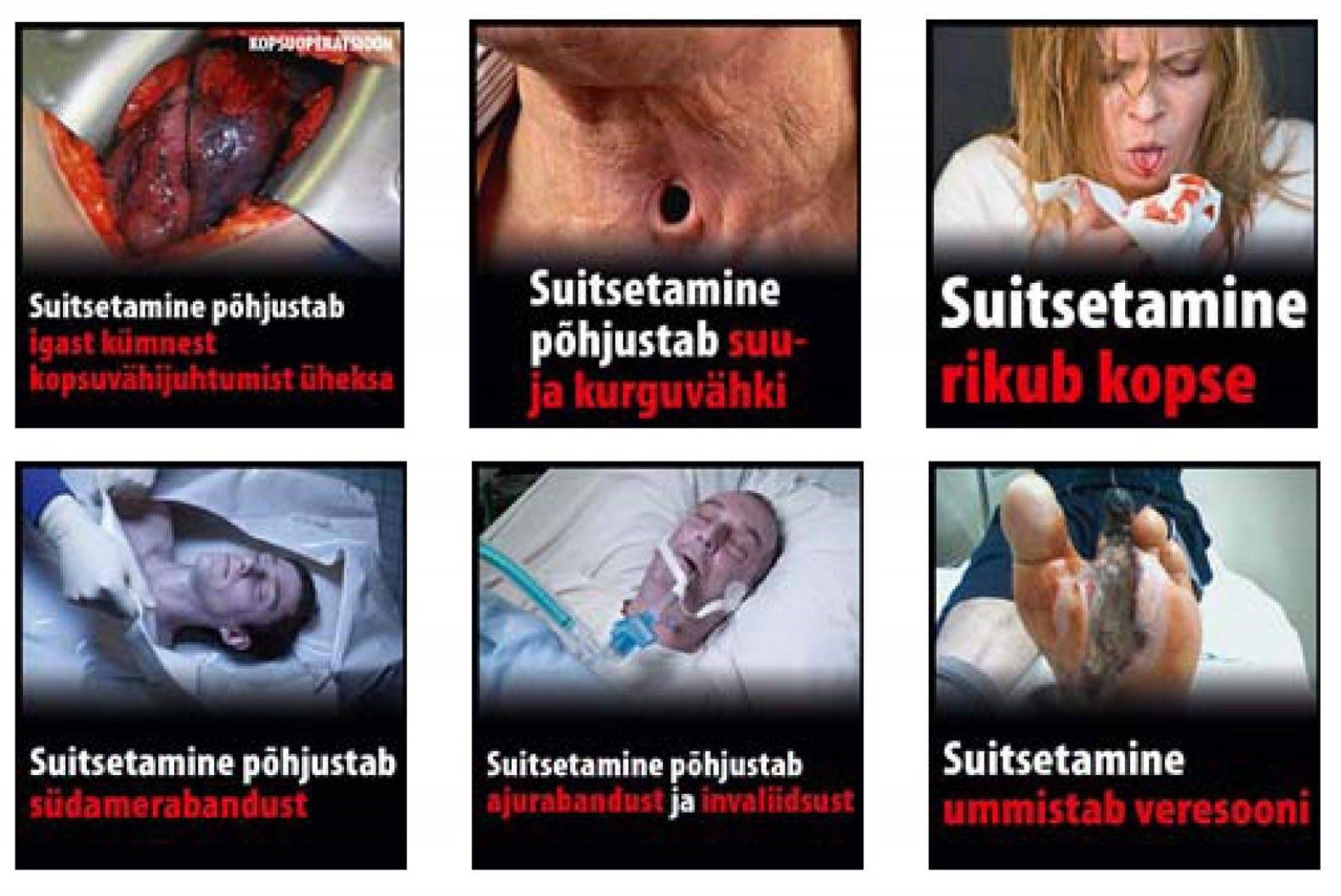 Sigaretipakkidele tulevad räiged eestikeelsed hoiatussildid