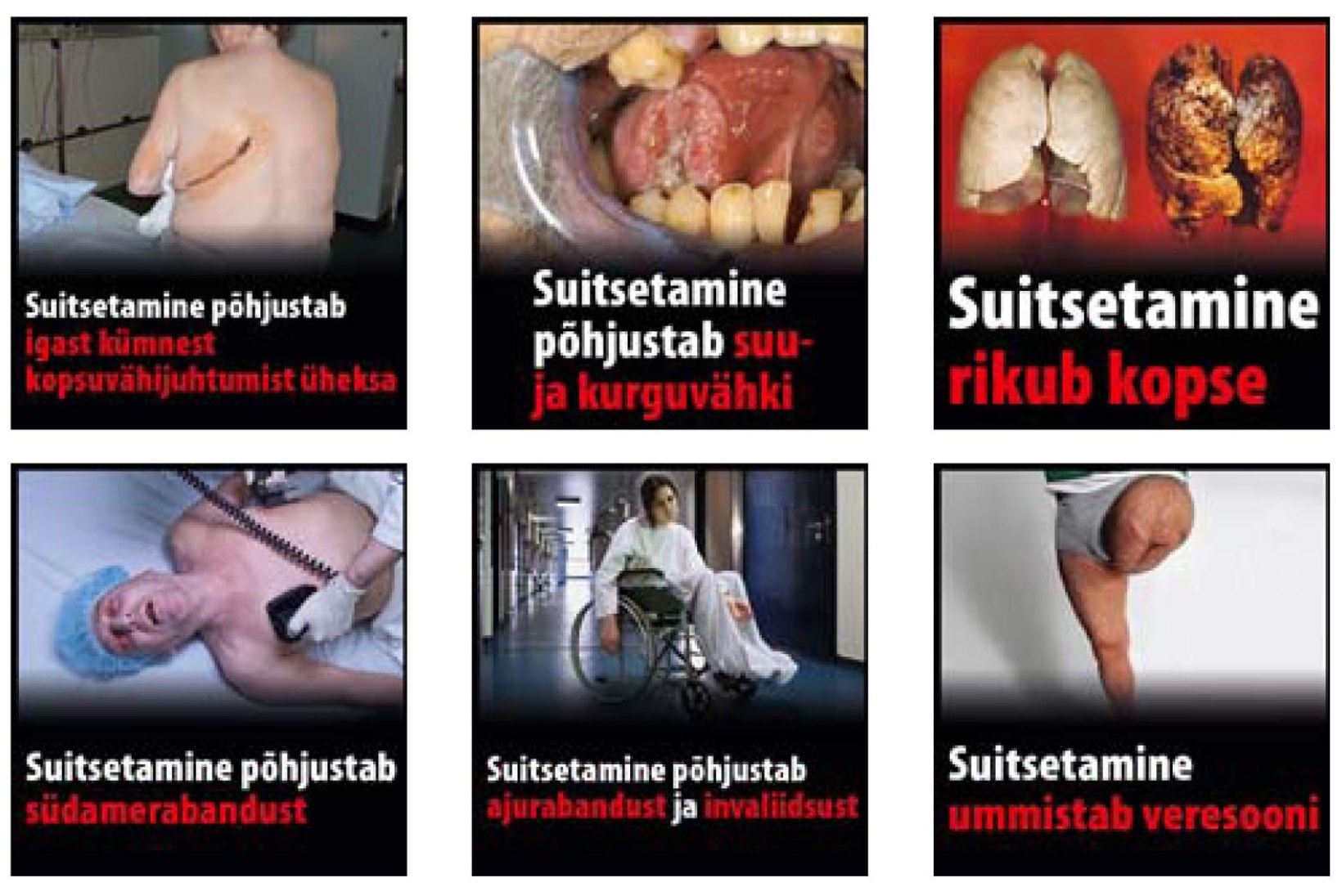 Sigaretipakkidele tulevad räiged eestikeelsed hoiatussildid