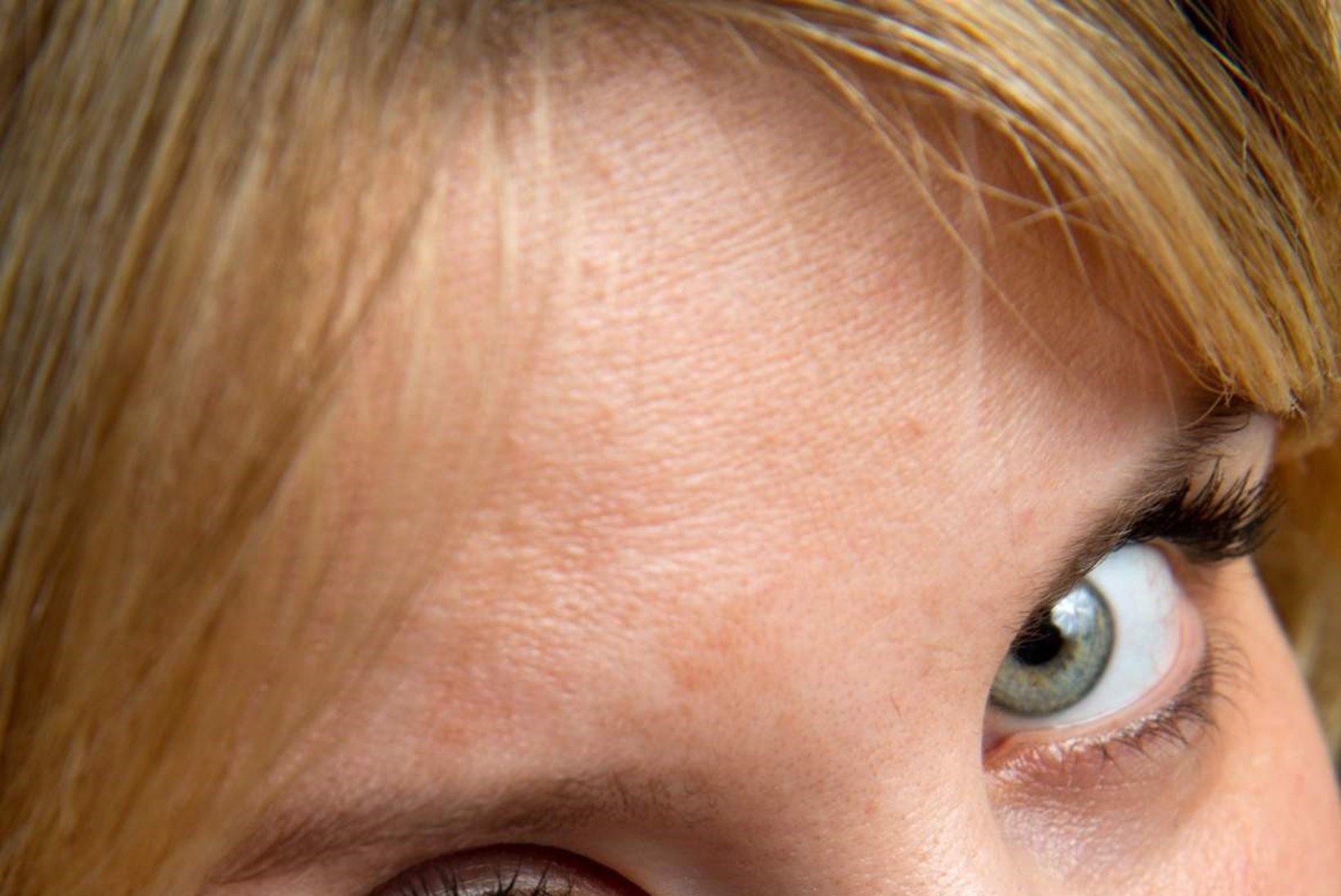 Kontaktläätsed: lohaka kasutamisega riskid silmakahjustustega