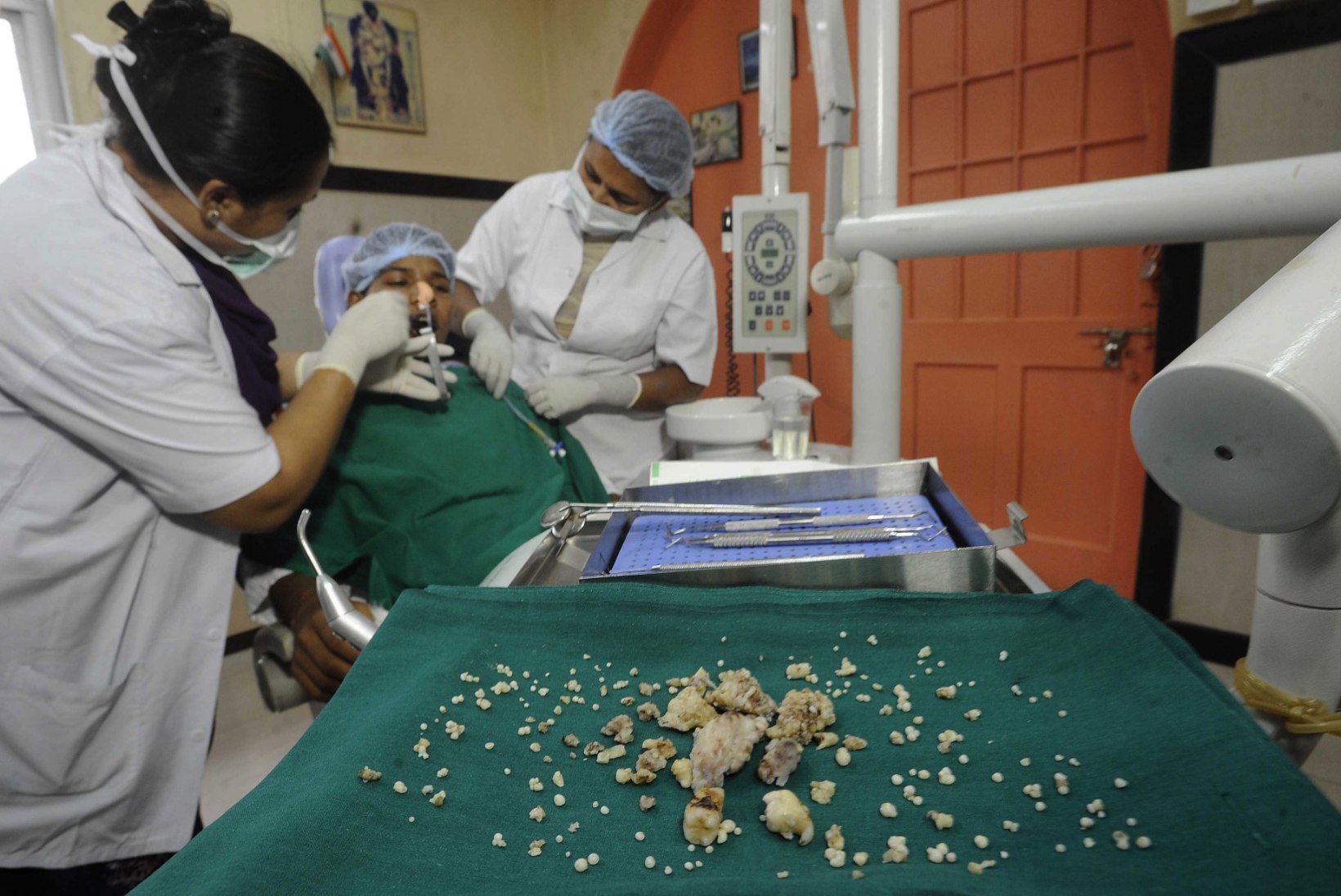 FOTOD: Indias eemaldati noormehelt 232 hammast!