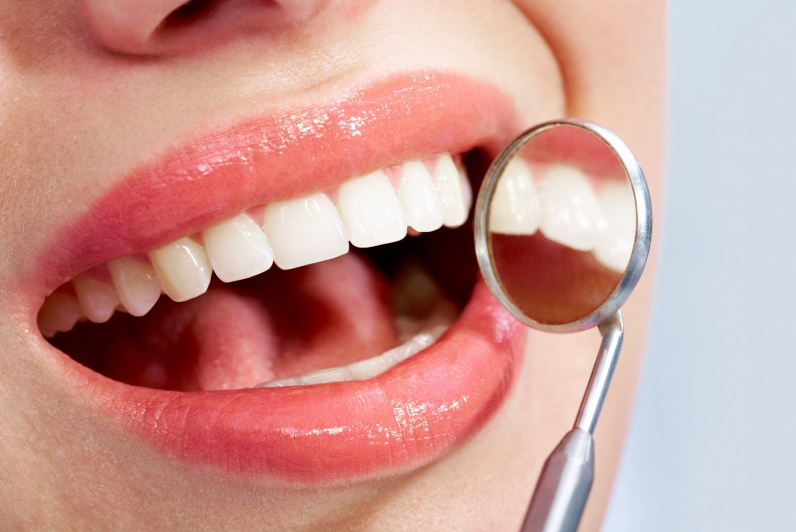 Kuidas saab hambaid valgemaks muuta?