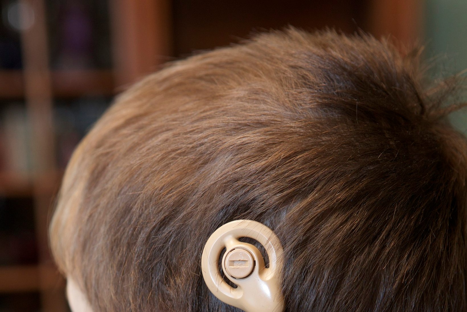 Nelja-aastane poiss saab lastefondi toel kuulmisimplantaadi