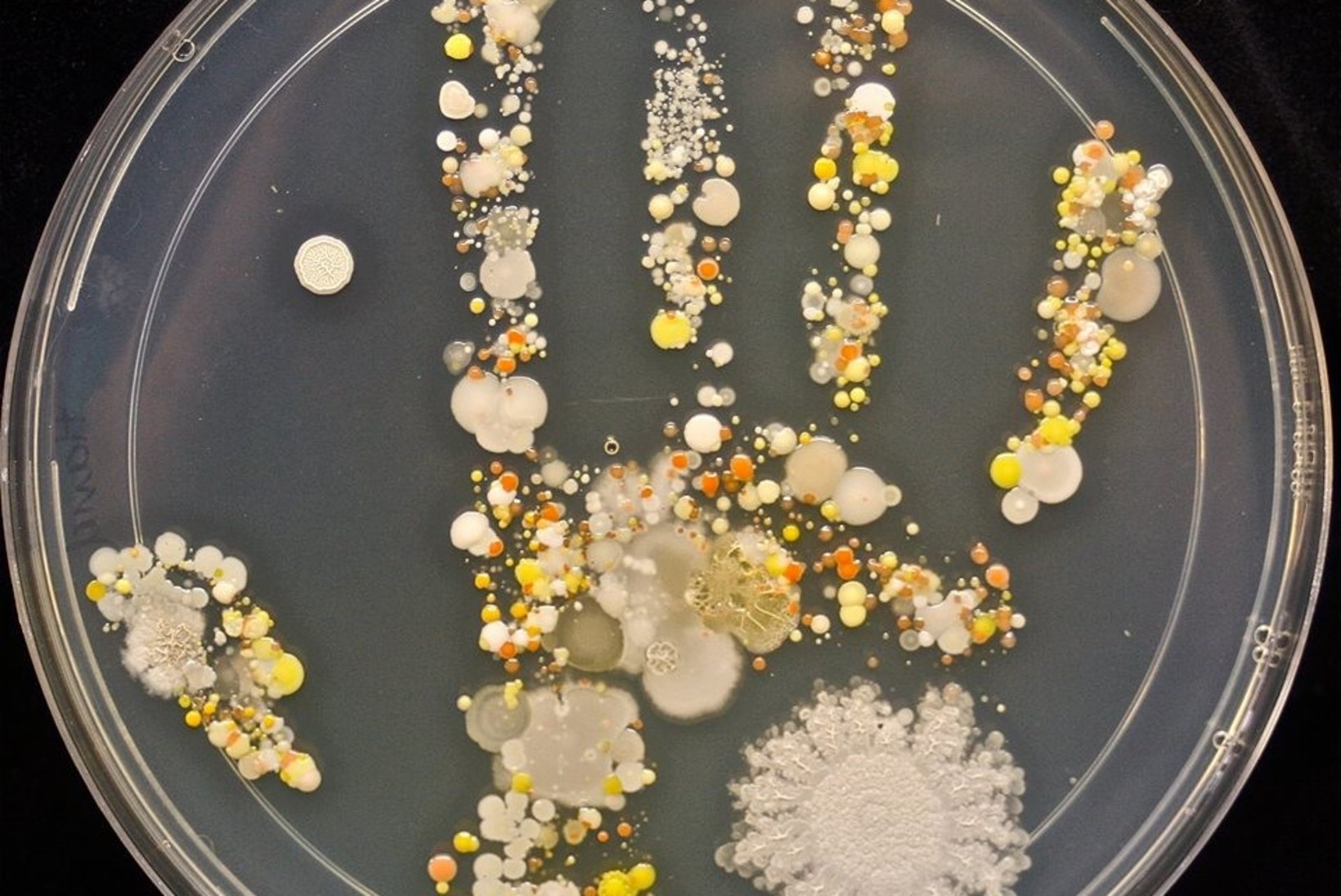 ŠOKEERIV FOTO: kui palju baktereid on 8-aastase lapse käel?