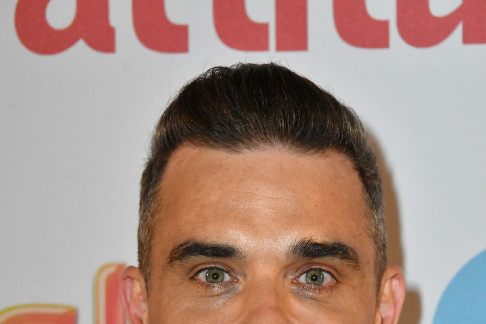 Robbie Williams lasi endale Botoxit ja täiteaineid süstida