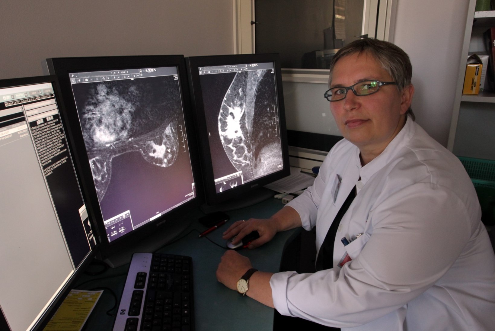 Regionaalhaigla tasuta rinnauuringute päeval leiti kolmel naisel rinnavähk