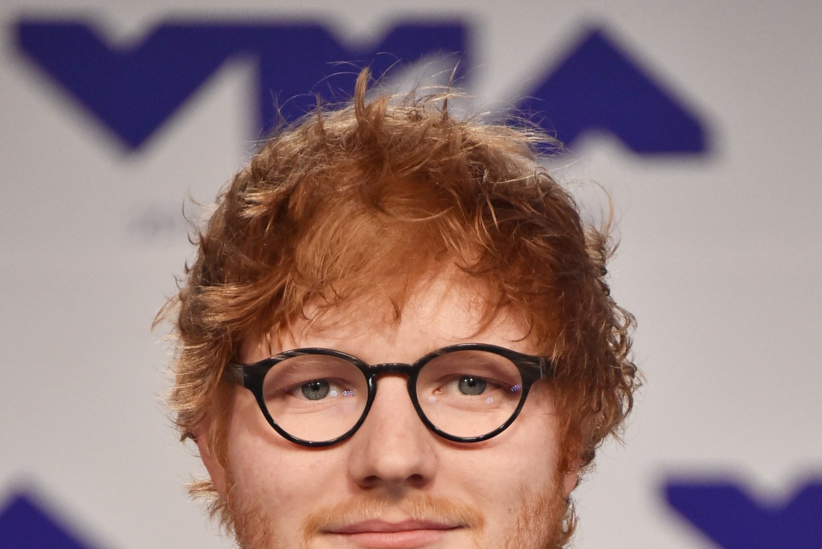 Ed Sheeran murdis liiklusõnnetuses käeluu