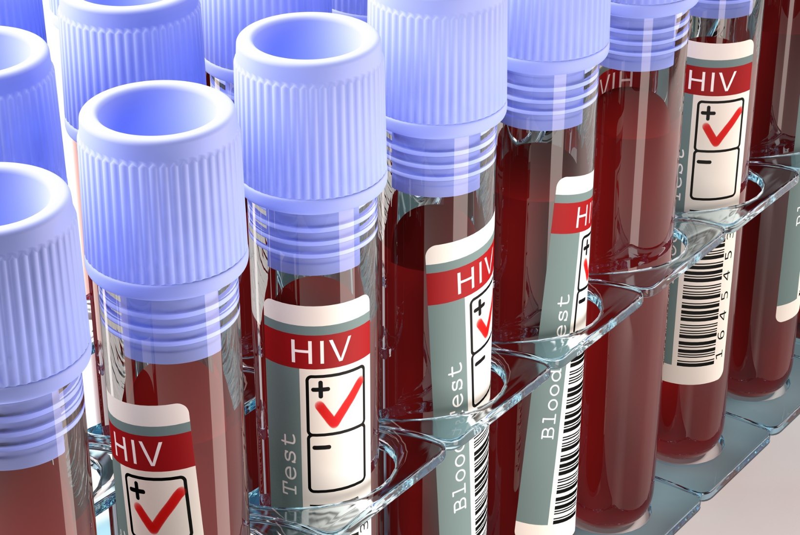 EPIDEEMIAOHT PÜSIB: vaata, kus saad end mugavalt HIV nakkuse suhtes testida