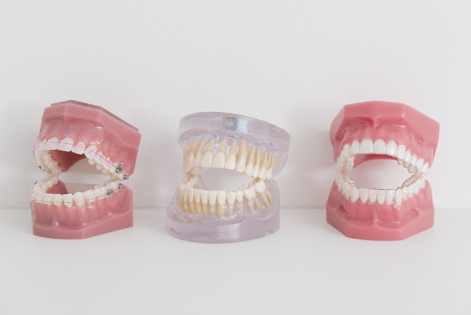 Jaanuarist kehtib haigekassa partnerite juures üle Eesti hammaste proteesidele sama hind