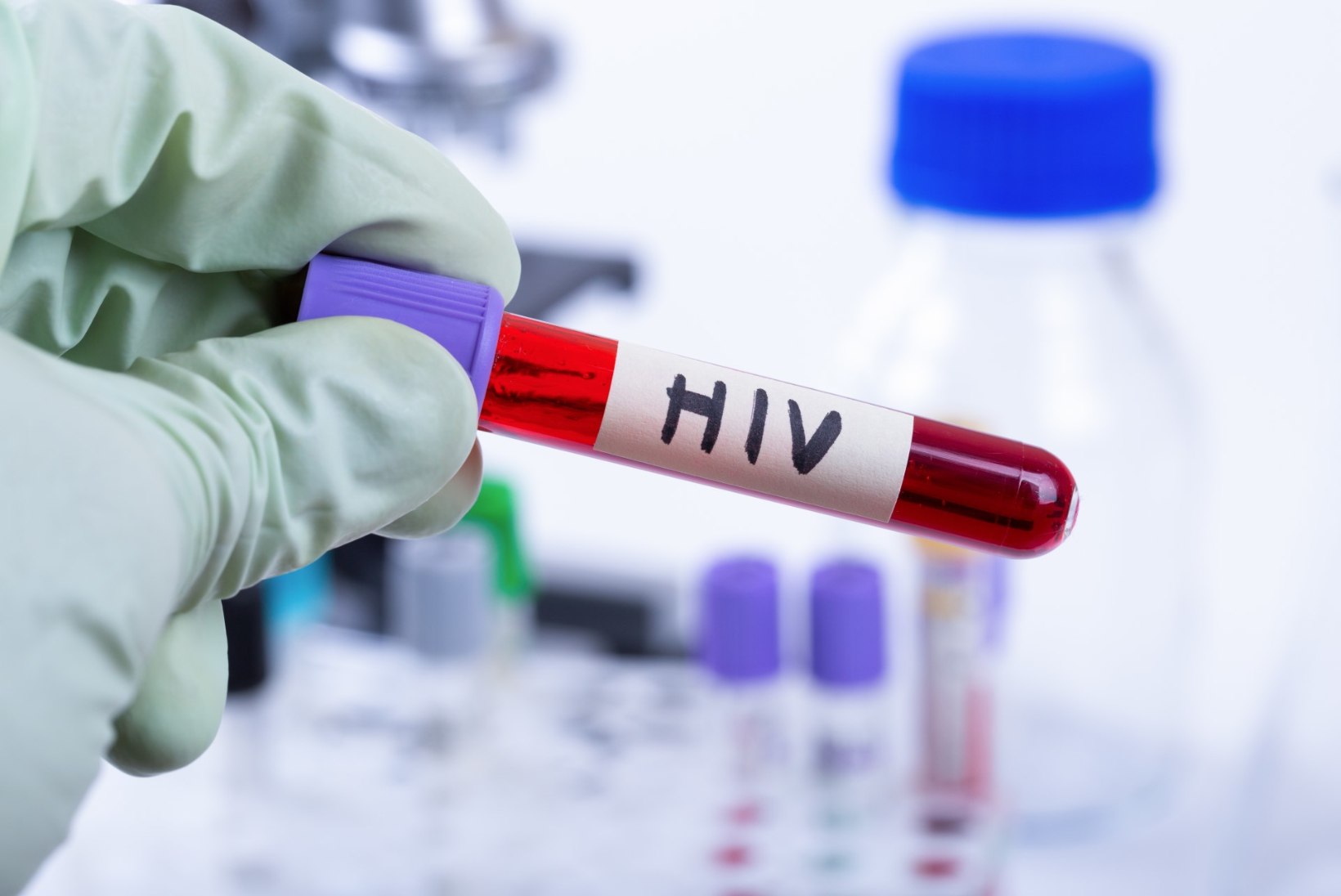Täna alanud HIV testimise nädalal saab kiirteste teha kaheksas linnas