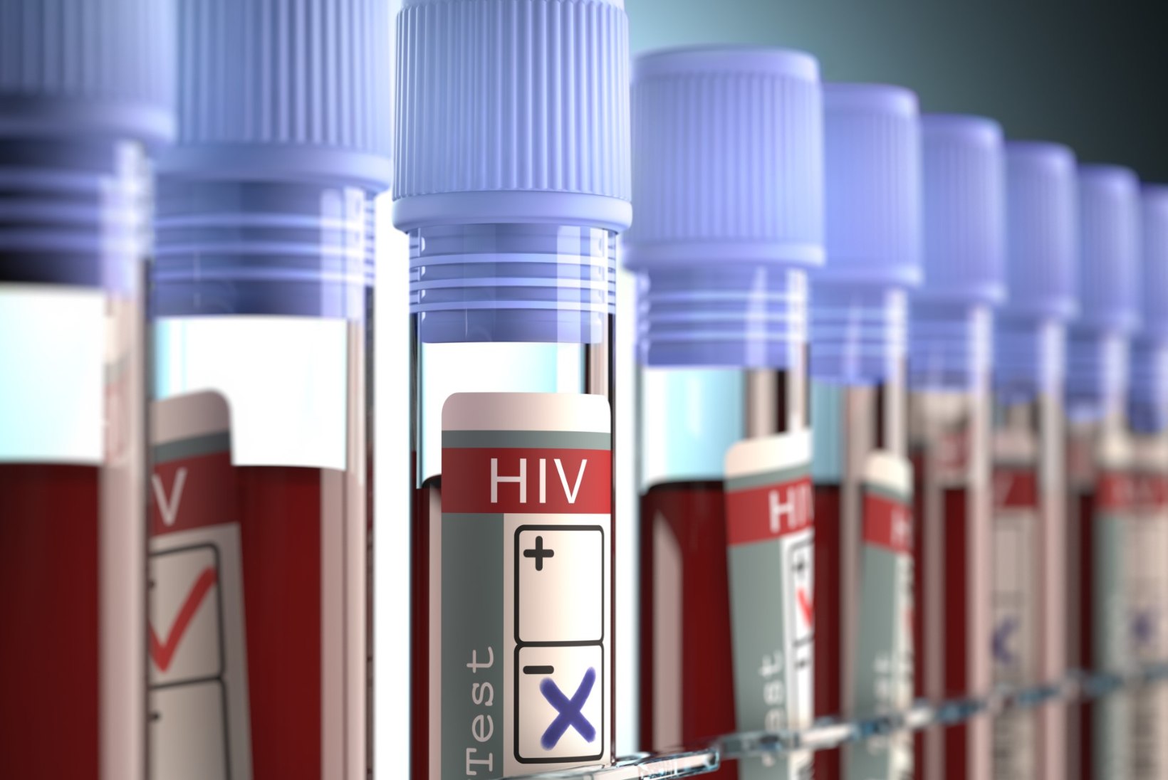 Uuring: Eesti elanikud ei tea, et HIVi nakatutakse aina enam sugulisel teel