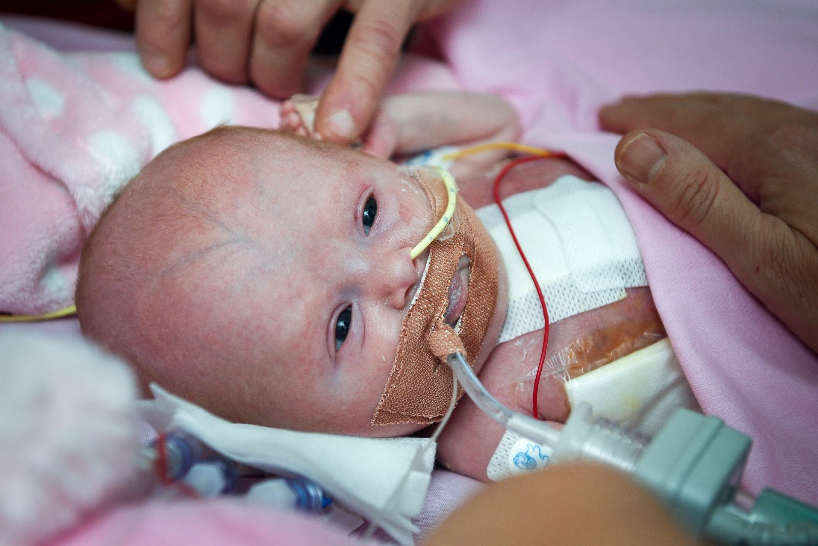 PISIKE VAPPER VÕITLEJA: beebi sündis süda väljaspool keha