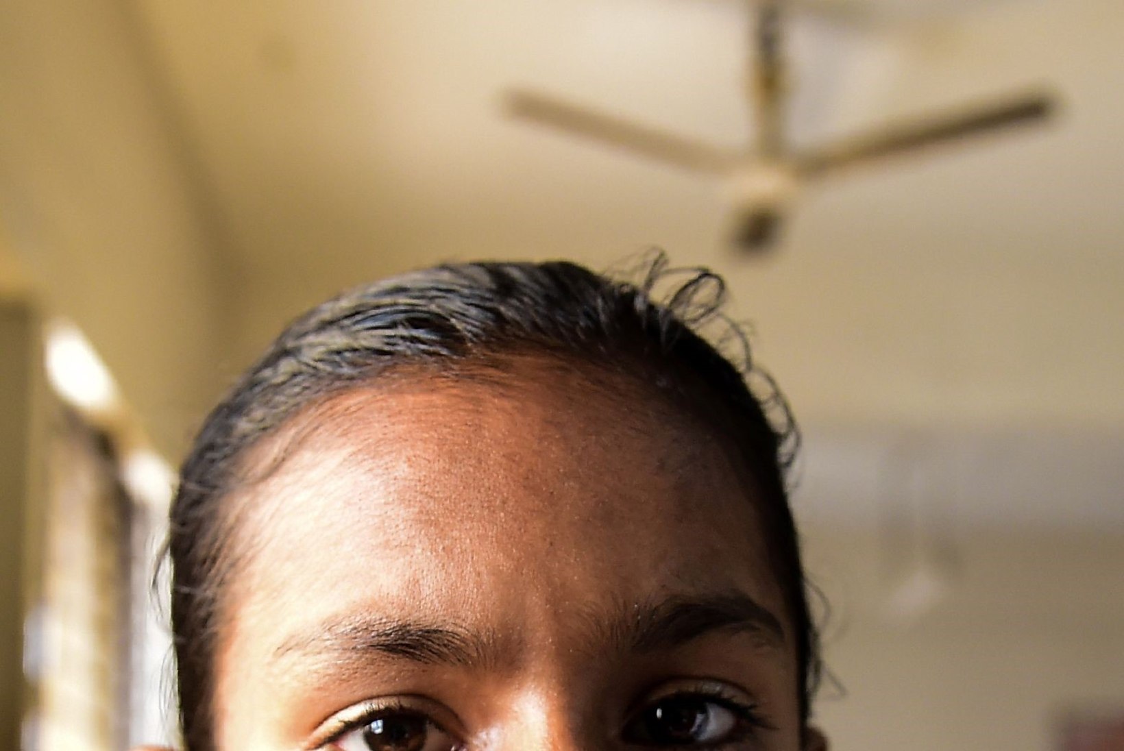 KAS NN PUUMEHE HAIGUS? 10aastase india tüdruku näol vohavad käsnad