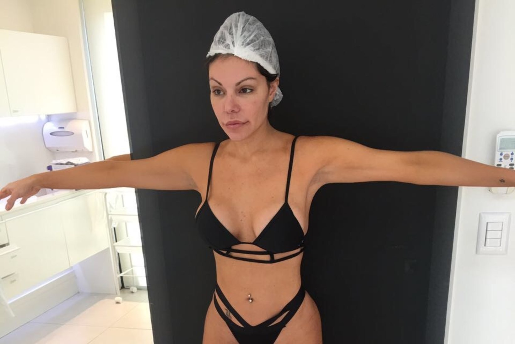 FOTOD | Modell lasi paigaldada tagumikuimplantaadi, et saada endale Kim Kardashiani pepu