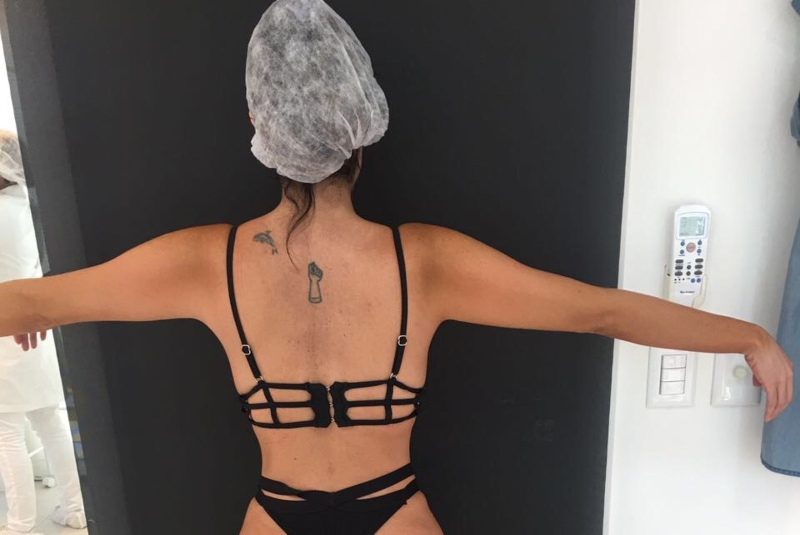FOTOD | Modell lasi paigaldada tagumikuimplantaadi, et saada endale Kim Kardashiani pepu