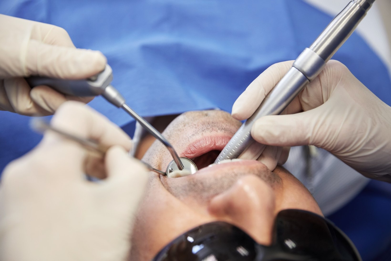 Hammaste siirdamine - hamba asendamise alternatiiv implantaatile