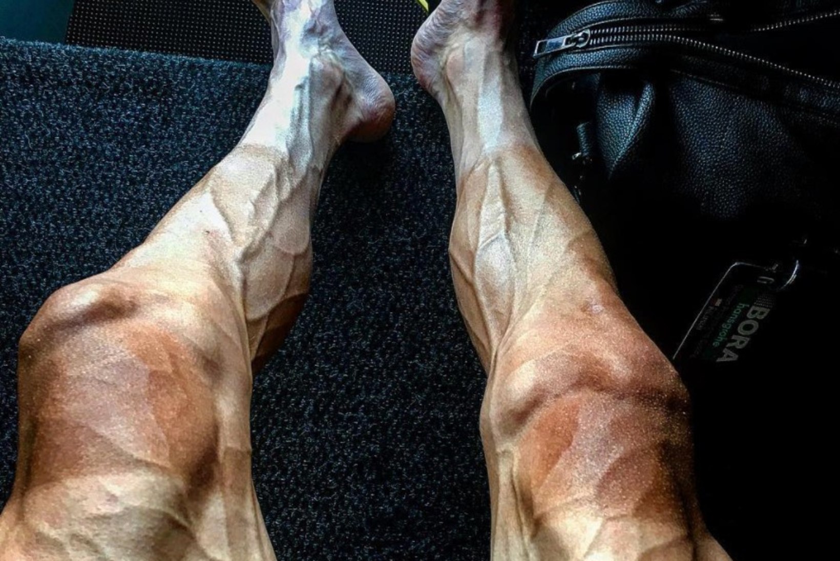 VÕIGAS FOTO | Profiratturi pulbitsevad veresooned on valmis tema jalast justkui välja plahvatama