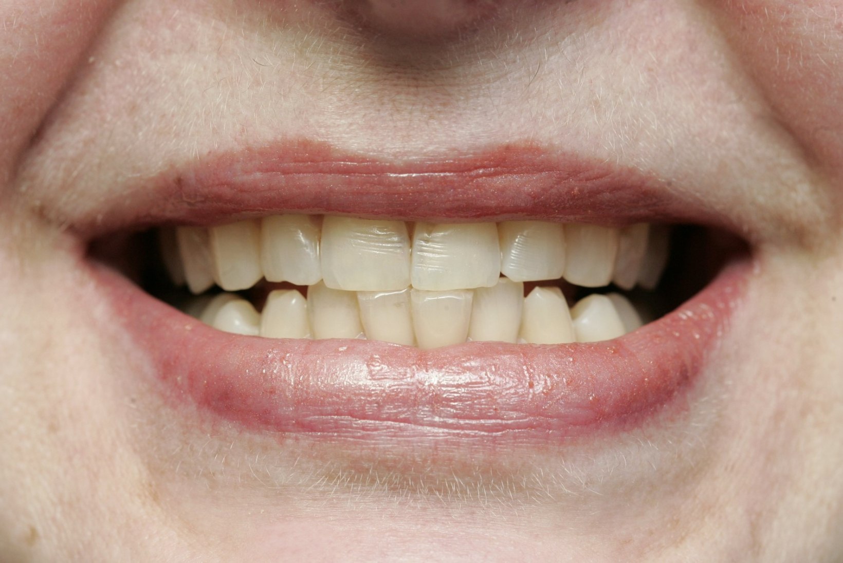 Juhtkiri | Hambaravihüvitis paneb hambaid kiristama