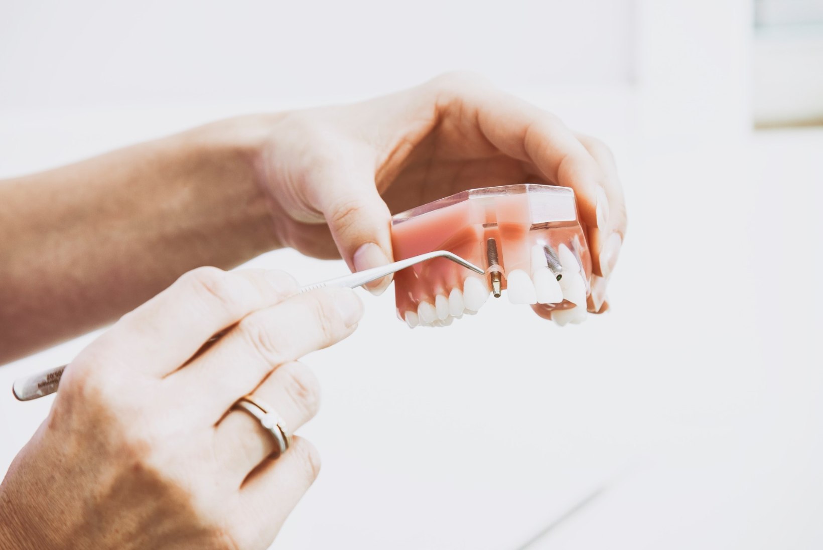 Öise hammaste krigistamine tagajärjel võib hambutuks jääda!