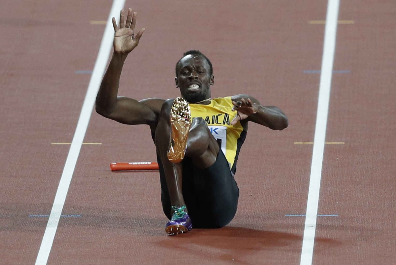 Ei mingit teesklemist: Usain Bolt näitas, kui ränga vigastuse ta sai