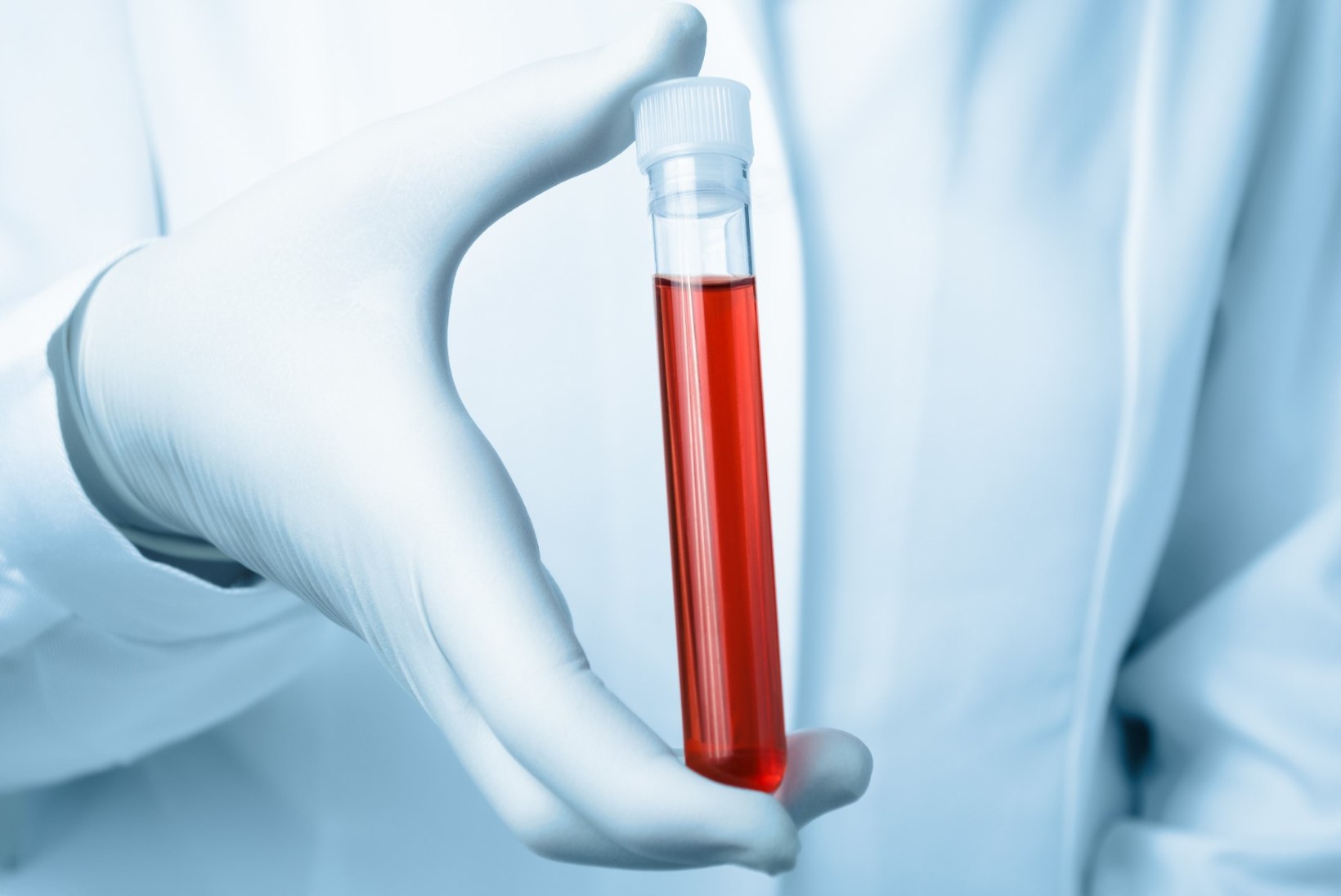Tartu Ülikooli teadlased leidsid, et kõrged põletikunäitajad võivad inimese vererakke kaitsta