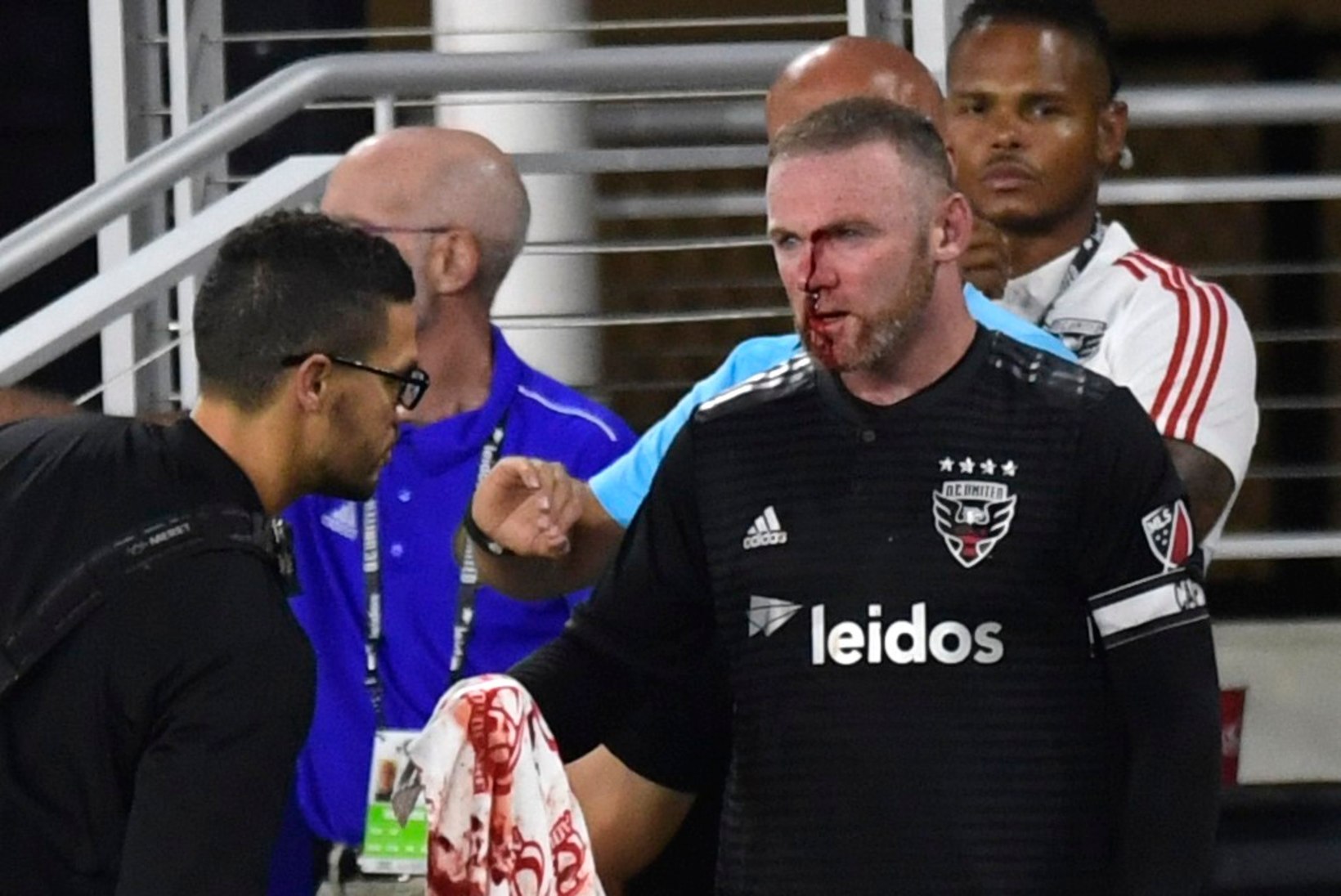 VERINE VIDEO | Wayne Rooney murdis nurgalööki kaitstes ninaluu