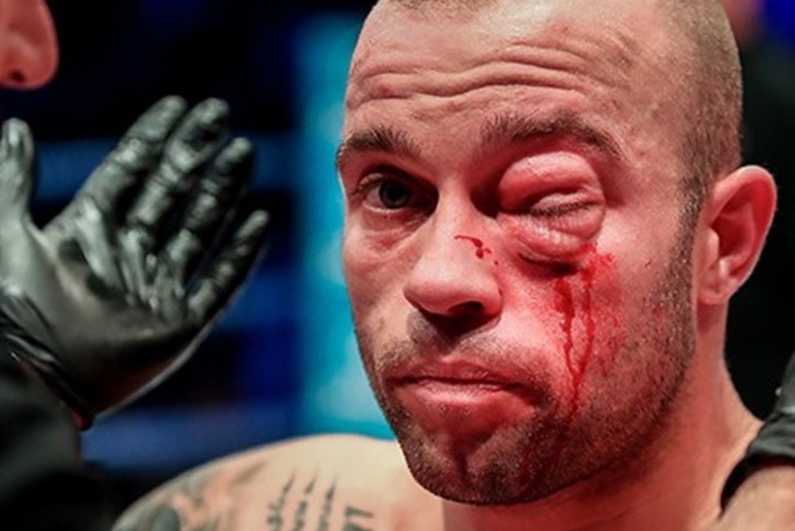 VIDEO | MMA-võitlejal paistetas jõhkra põlvehoobi järel silm kinni