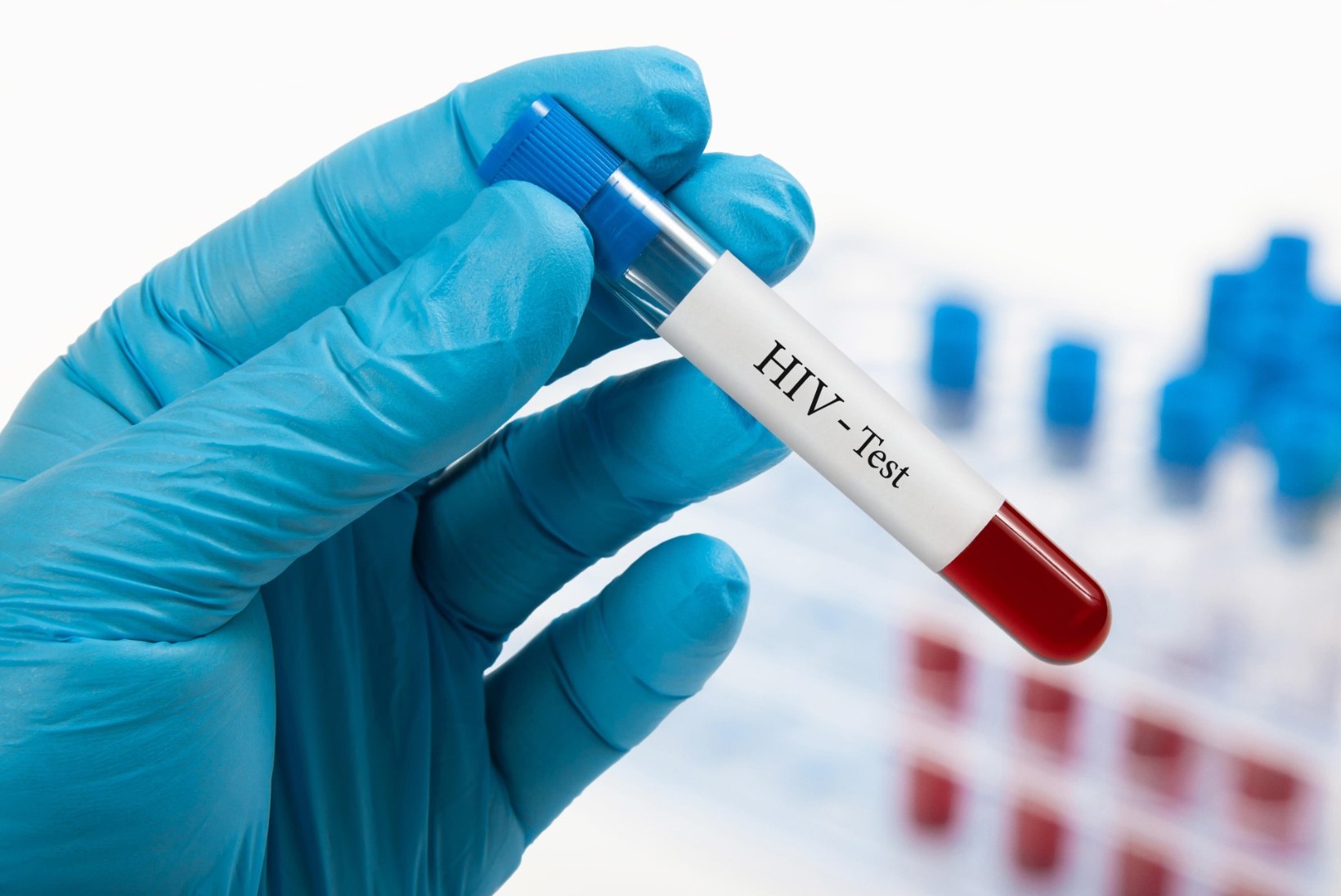 HAIGUS EI ANNA KAUA TUNDA: Tallinnas ja Ida-Virumaal peaks HIV-teste tegema palju rohkem