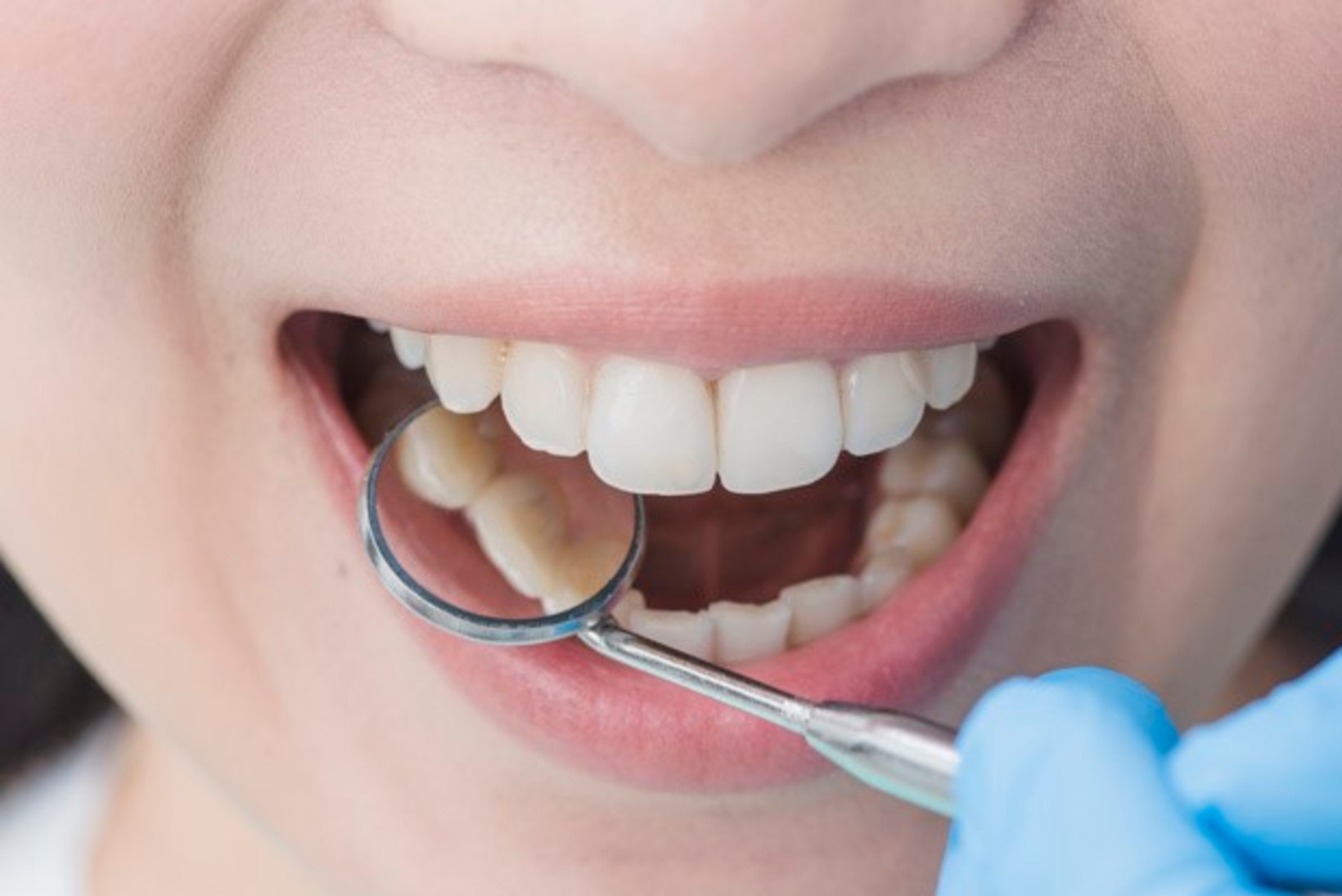 Hammaste tervise kuu: kas sina pesed oma hambaid õigesti? 