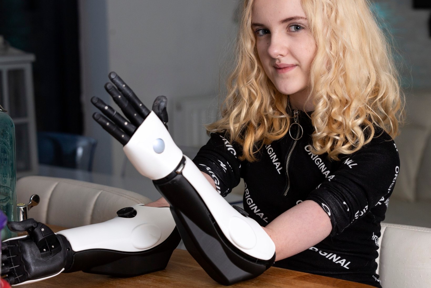 Meningiidi tõttu käed kaotanud tüdruk sai 3D-printeriga tehtud proteesid