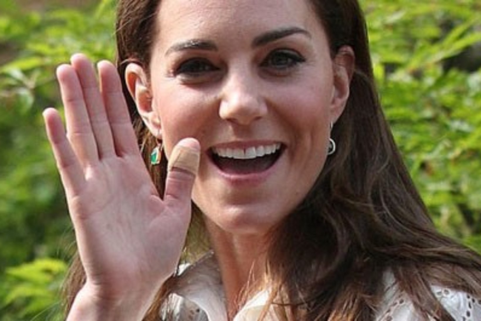 MÕISTATUS: miks on hertsoginna Catherine’i sõrmed alailma plaasterdatud?!