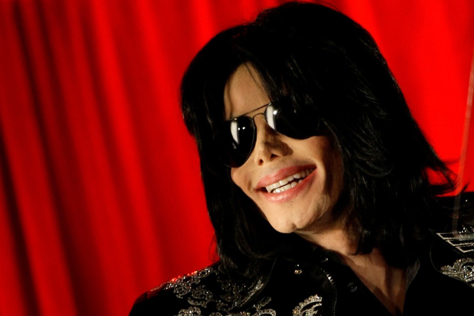 ŠOKEERIV! Michael Jackson oli surres kiilakas ja tema pead katsid armid