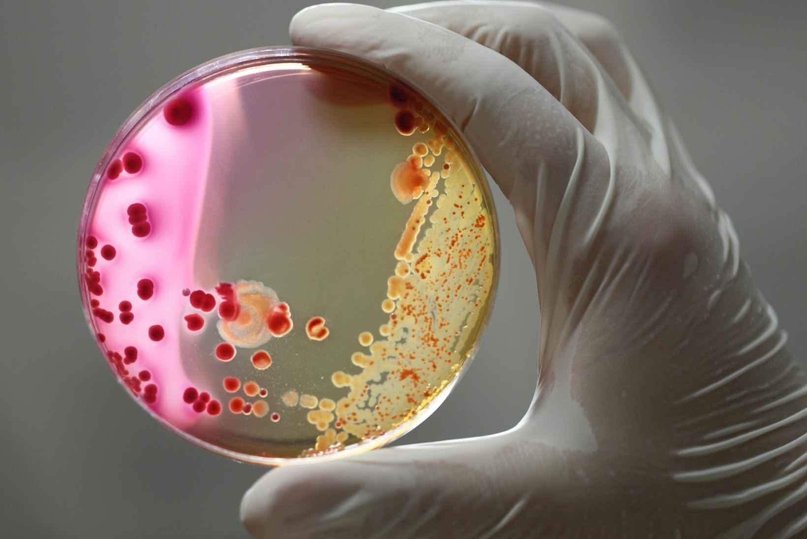 RAVIMID EI MÕJU: bakterid oskavad teha striptiisi ja antibiootikumid ära petta