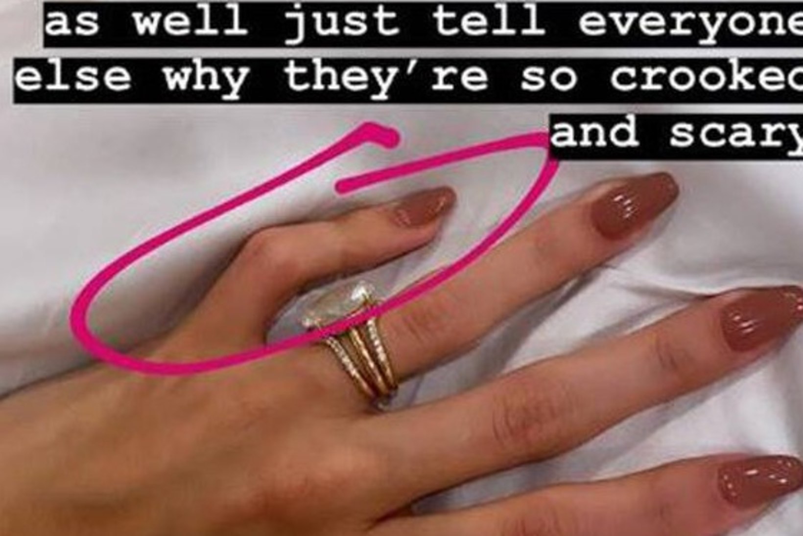 Miks on Justin Bieberi naise sõrmed võikalt kõverikud?!