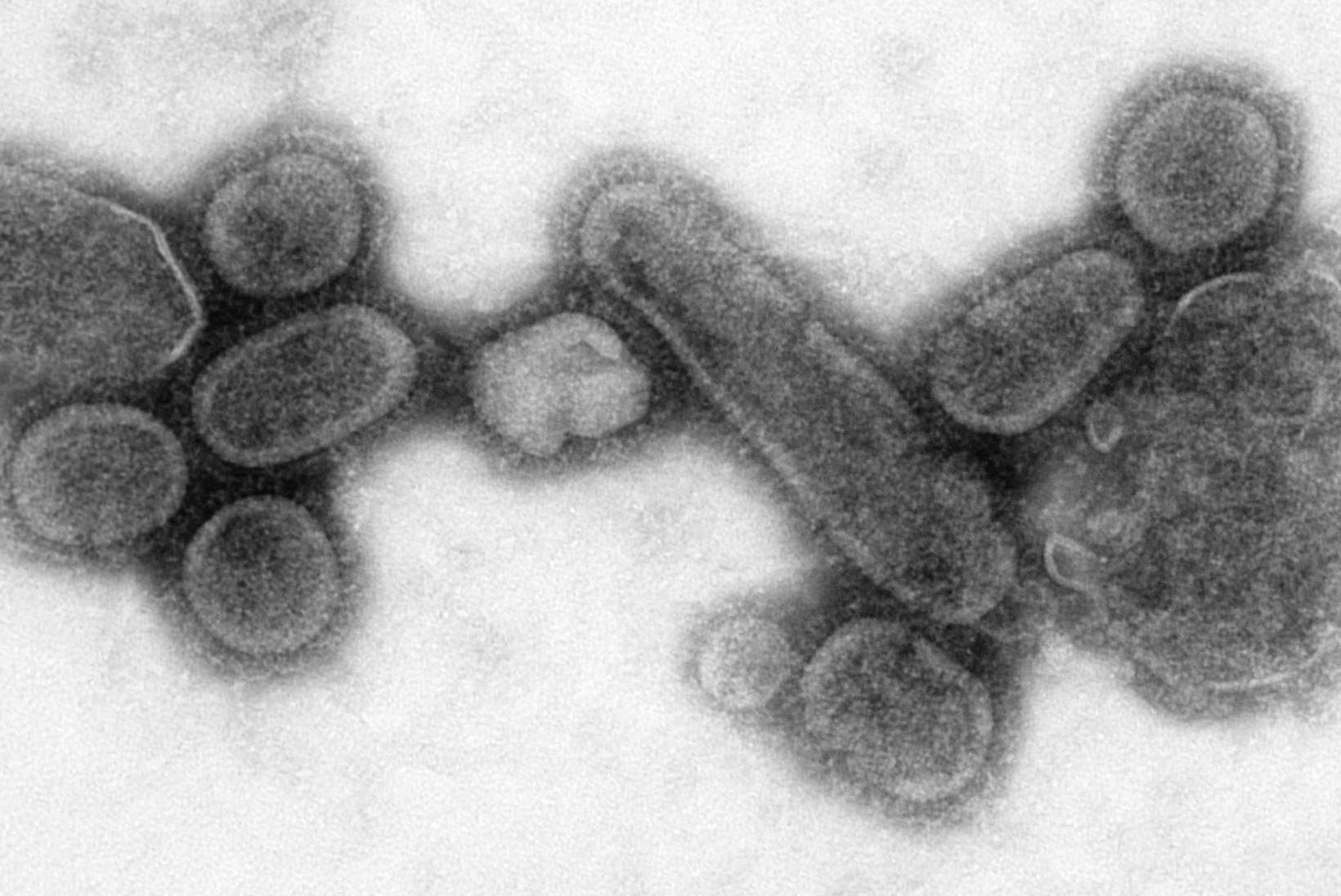 Hispaania gripp – pandeemia, mis nõudis ligi 50 miljonit inimelu