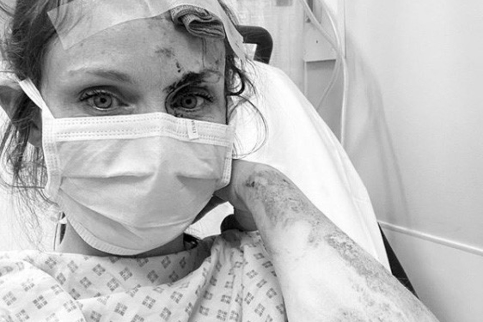 Sophie Ellis-Bextor poseerib verisena haiglavoodis
