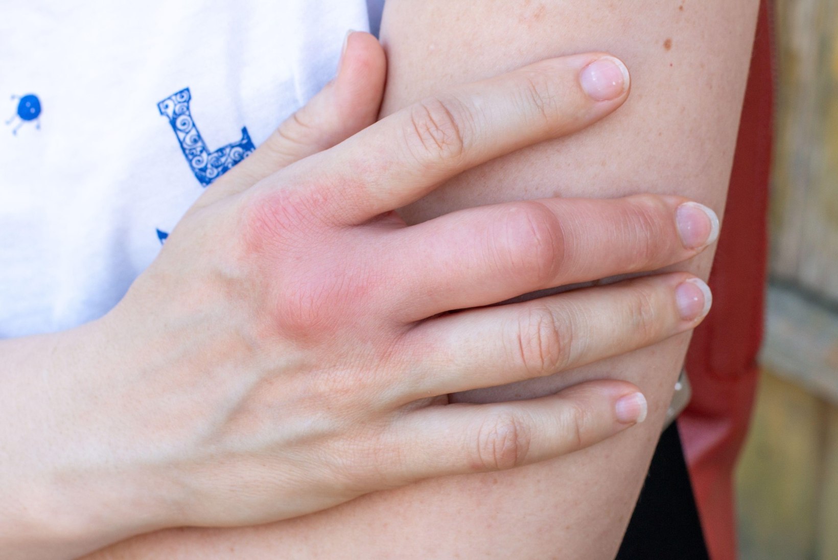 ELUOHTLIK SUTSAKAS MESILASELT: need on neli peamist suvise allergia põhjustajat