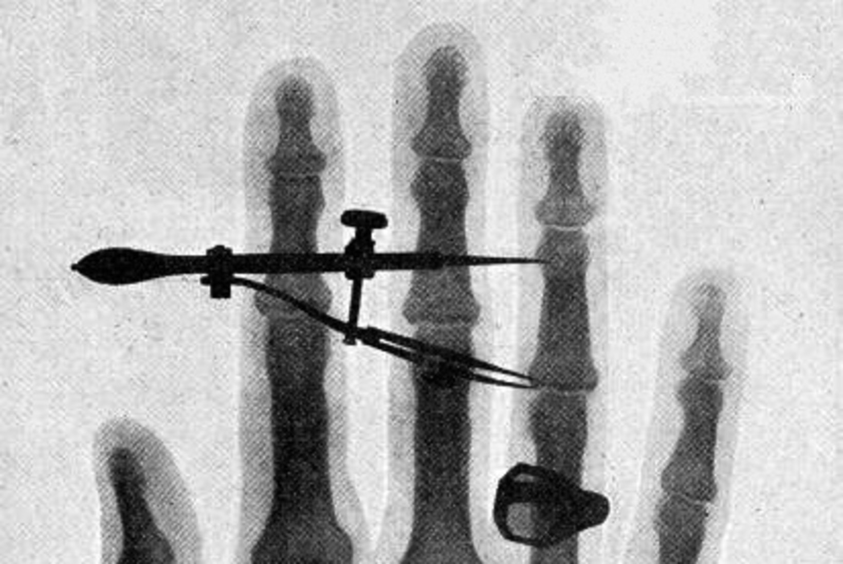 „Ostke piilumiskindlat pliipesu röntgenprillide vastu!“ 