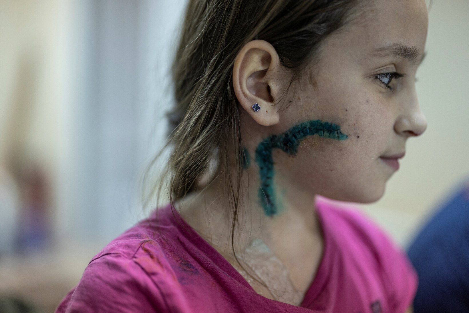 ŠOKEERIVAD FOTOD | Ukrainas sõjas vigastatud lapsi raviv arst: „Mõned neist on surma äärel.“