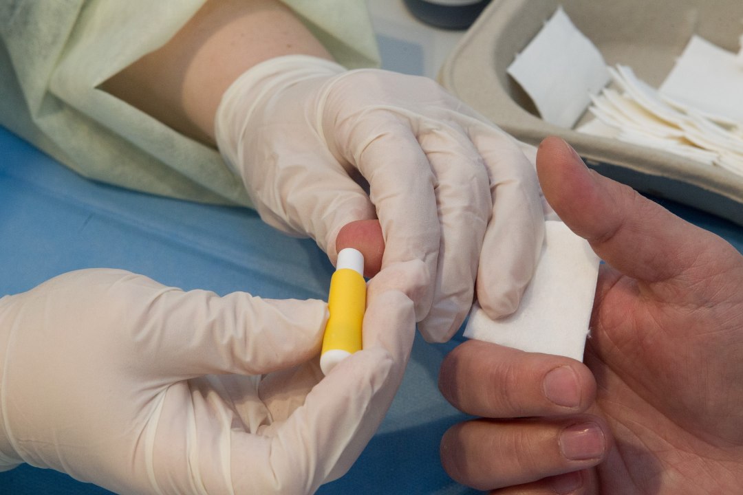 HIV-epideemia: kas tõesti testimine kohustuslikuks igale eestlasele?