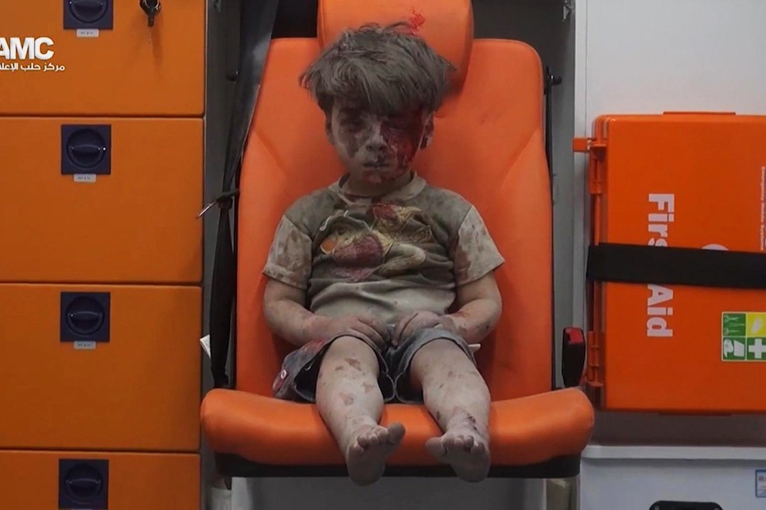 VIDEO | Kuidas läheb Süüria kodusõja sümbolilks saanud 5aastasel Omranil?