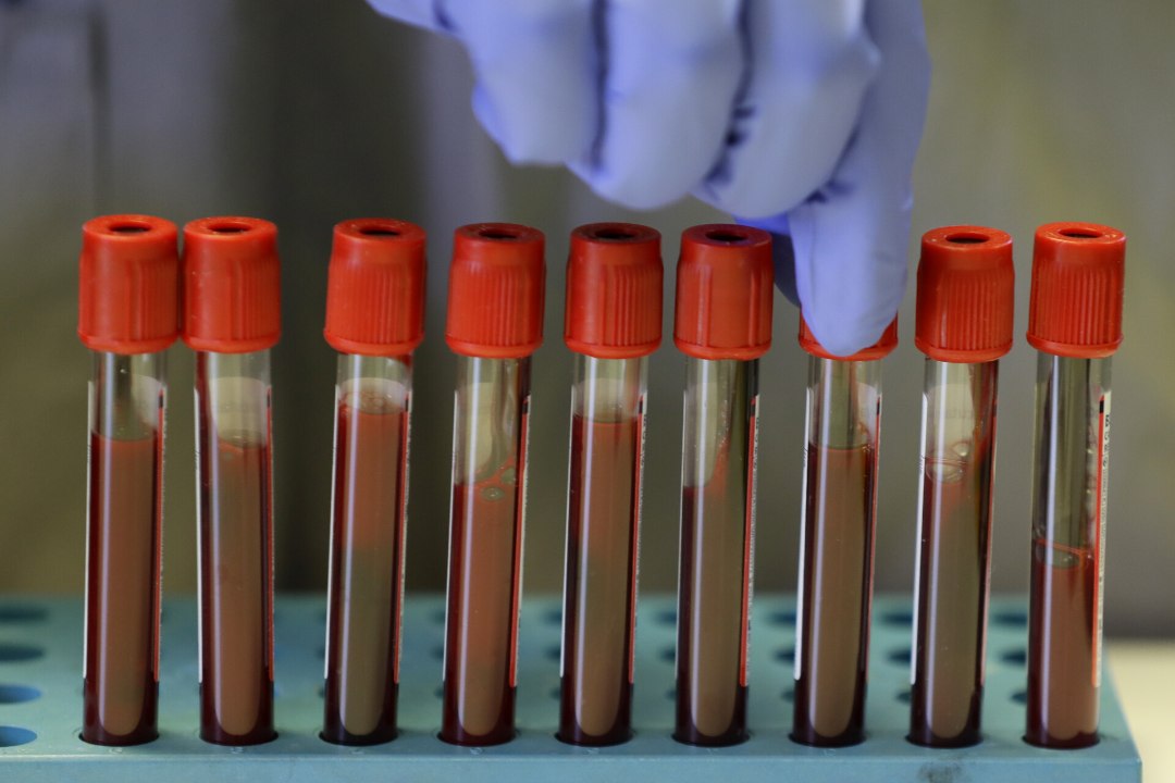 TÕHUS JA KIIRESTI HAIHTUV: kas liivaussi hemoglobiinist saab dopingutarvitajate uus lemmik?