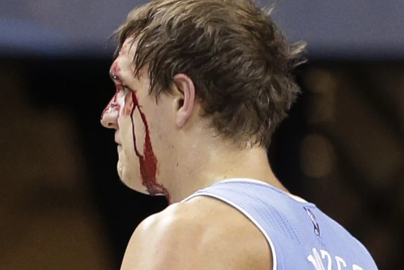 VIDEO: verd kah! Vastase küünarnuki otsa komistanud Venemaa NBA staar oleks kui seataputalgutel osalenud